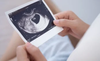 A woman holding an ultrasound photo of a fetus | Source: Shutterstock